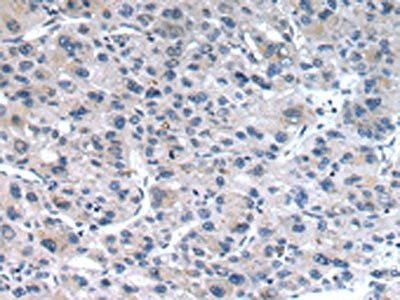 CLDN19 Antibody