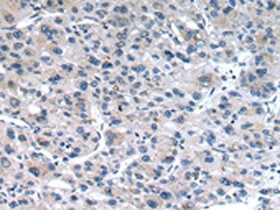 CLDN19 antibody