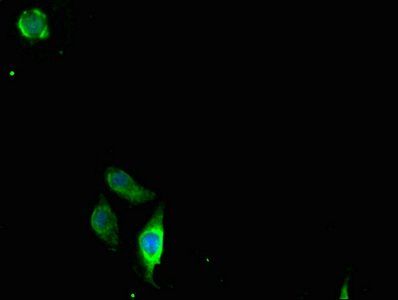 CLDN2 antibody