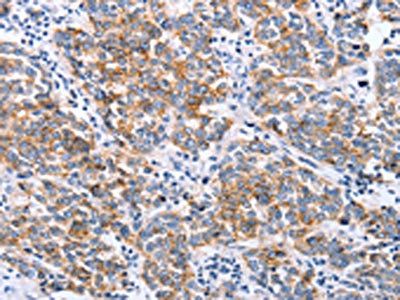 CLDN3 Antibody