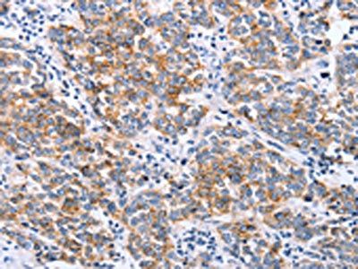 CLDN3 antibody