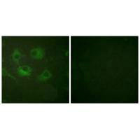CLDN3 Antibody