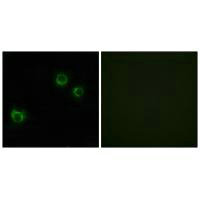 CLDN6 Antibody