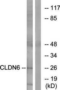 CLDN6 Antibody