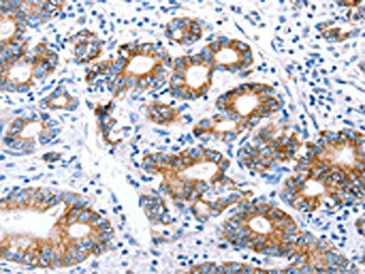 CLDN7 Antibody