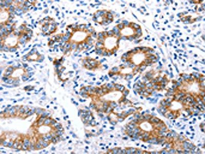 CLDN7 antibody