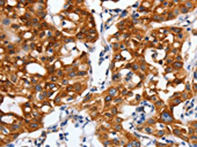 CLDND1 Antibody