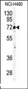 Cleavage stimulation factor 2 antibody
