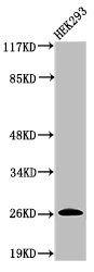 Cleaved-C1R (I464) antibody
