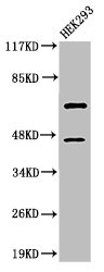 Cleaved-CASP8 (D384) Antibody