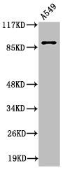 Cleaved-ITGAV (K889) Antibody