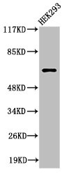 Cleaved-ITIH2 (D702) Antibody
