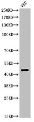 Cleaved-KLKB1 (R390) antibody