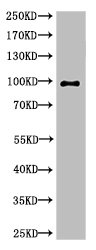 Cleaved-PARP1 (G215) antibody