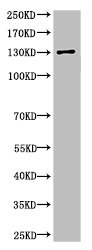 Cleaved-SPTAN1 (D1185) antibody