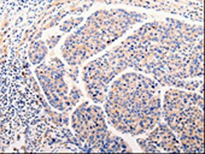 CLEC10A Antibody