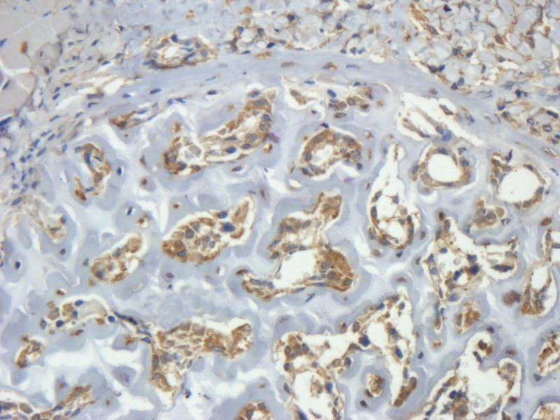 CLEC1B antibody