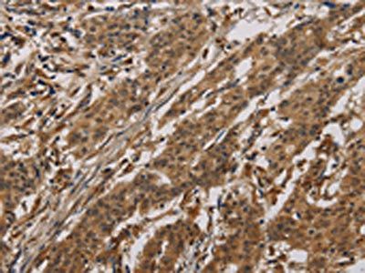 CLEC2A Antibody