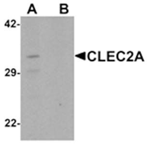 CLEC2A Antibody