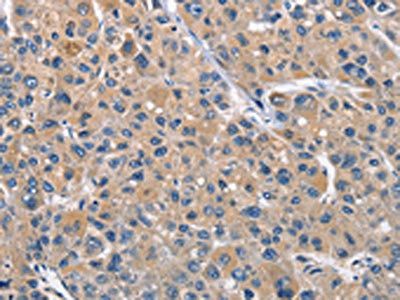 CLEC2D Antibody