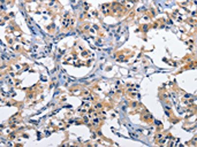 CLEC2D antibody