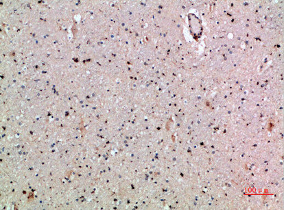 CLEC4A Antibody