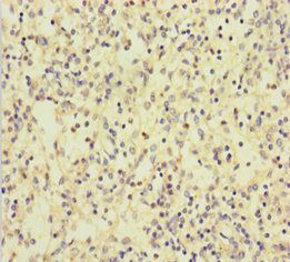 CLEC4D Antibody