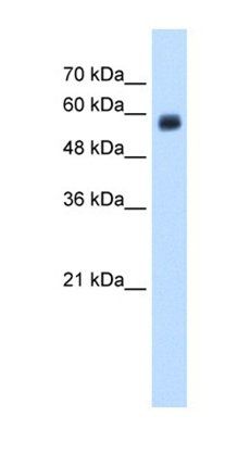 CLEC4M antibody