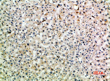 CLEC4M antibody