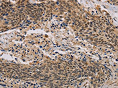 CLEC5A Antibody