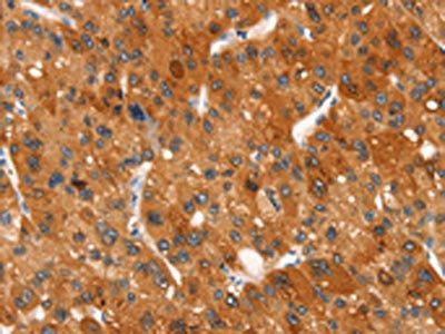 CLEC6A Antibody