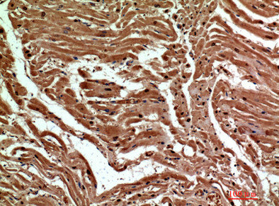 CLEC6A Antibody