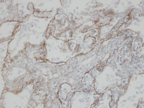 CLIC3 Rabbit Polyclonal Antibody