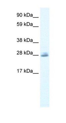 CLIC5 antibody