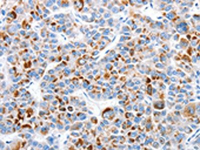 CLIP1 Antibody