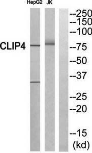 CLIP4 antibody