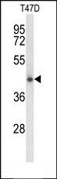 CLN5 antibody