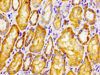 CLN6 Antibody
