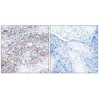 CLN6 Antibody