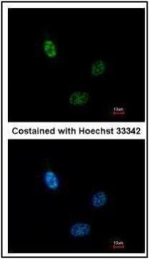 CLP1 antibody