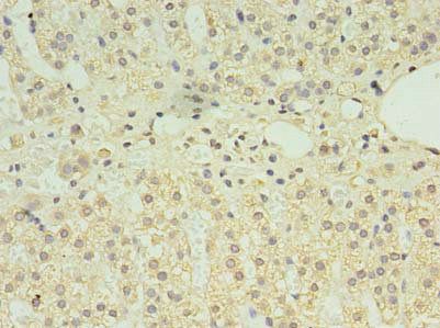 CLPB Antibody