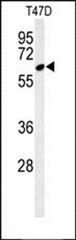 CLPB antibody