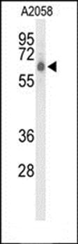 CLPTM1L antibody