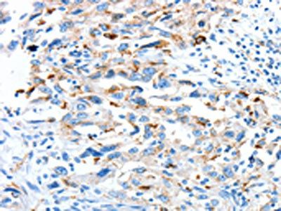 CLPTM1L antibody