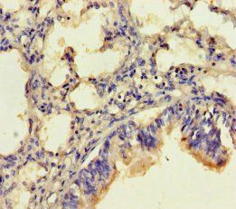 CLRN2 Antibody