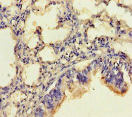 CLRN2 antibody