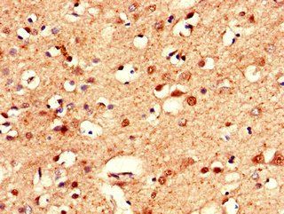 CLSTN2 antibody