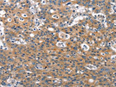 CLTC Antibody