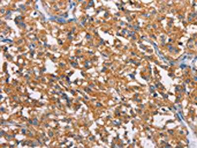 CLTC Antibody