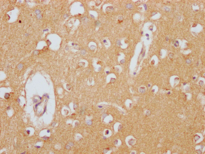 CLU Recombinant Monoclonal Antibody